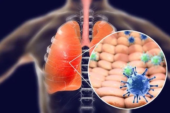 Wuhan Coronavirus Salgını (2019-nCoV): Bilmeniz Gereken En Önemli Konular Nelerdir ?